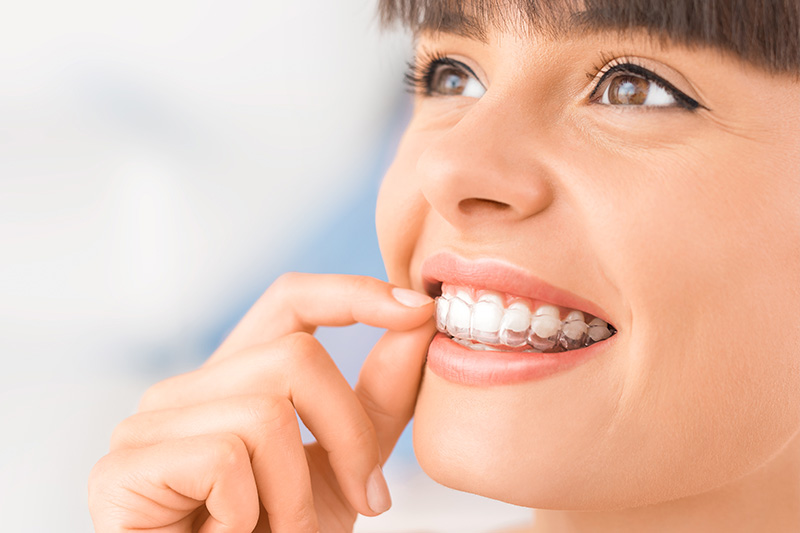 Invisalign in Greybull