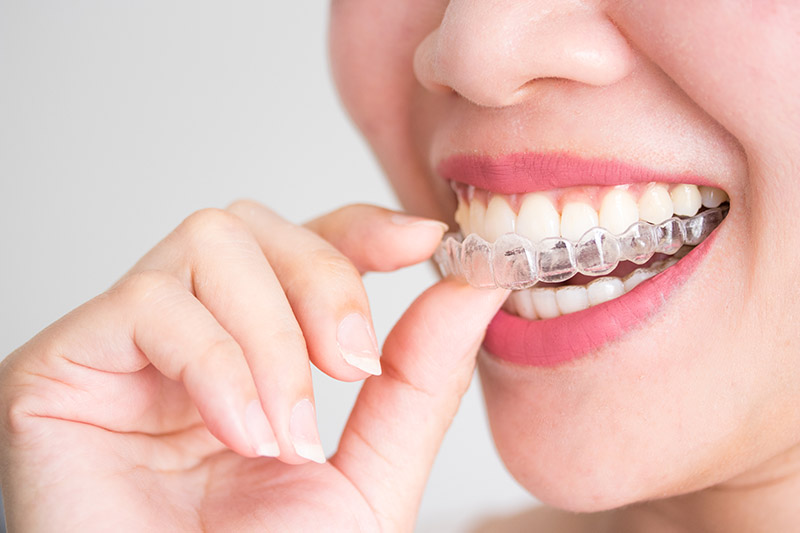 Orthodontics in Greybull